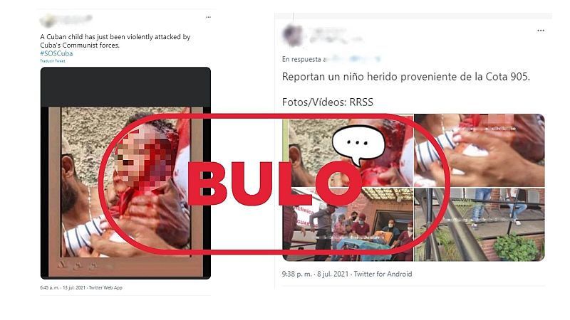 Bulo: niño herido de bala en protestas en Cuba