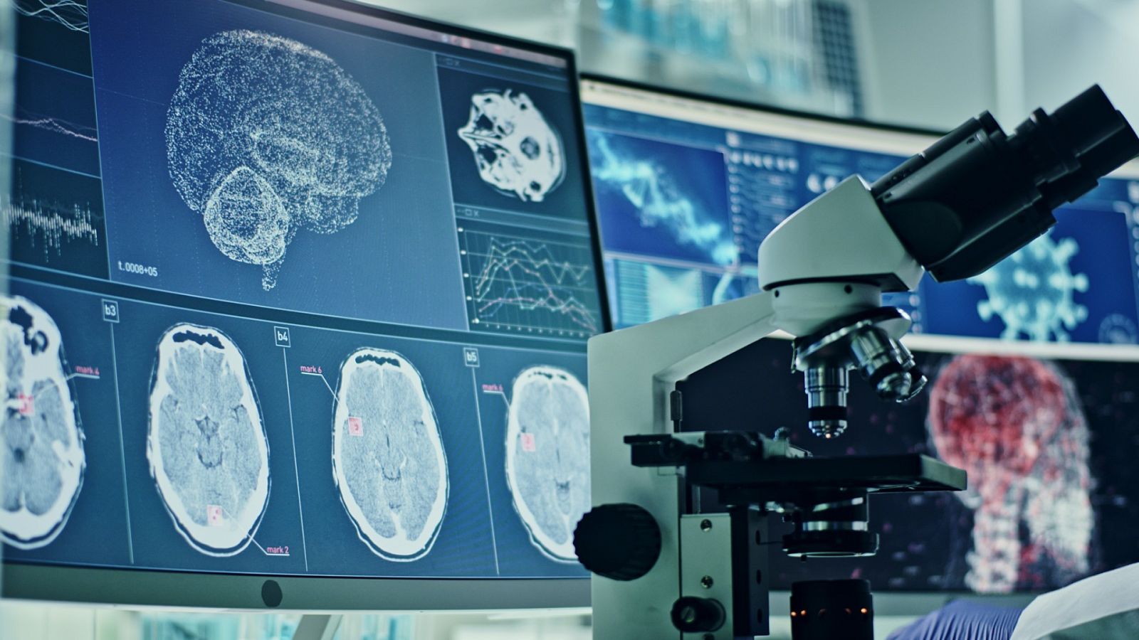 Un microscopio frente a una pantalla de ordenador con radiografias craneales