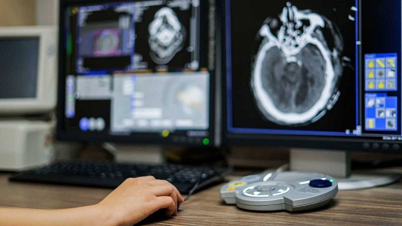 Un grupo de científicos desarrolla un dispositivo de comunicación para personas con parálisis total.