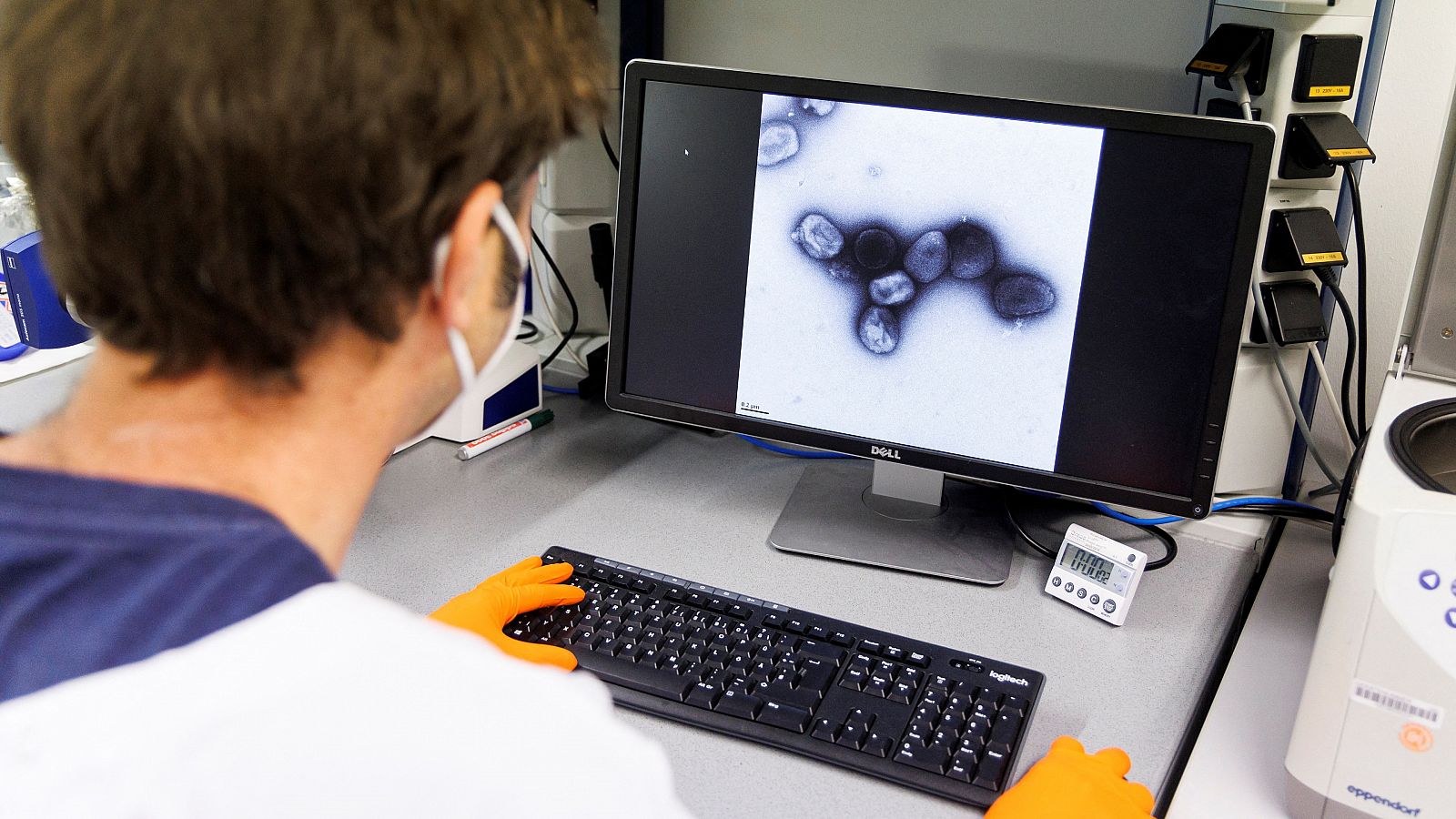Un científico observa la imagen microscópica del virus de la viruela del mono a través de un ordenador.