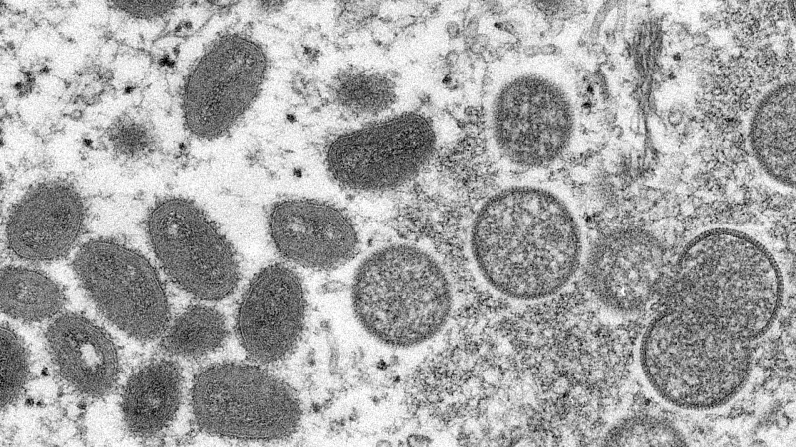 Imagen del microscopio electrónico de 2003, facilitada por los Centros para el Control y la Prevención de Enfermedades, muestra, a la izquierda, viriones maduros y ovalados de la viruela del mono.