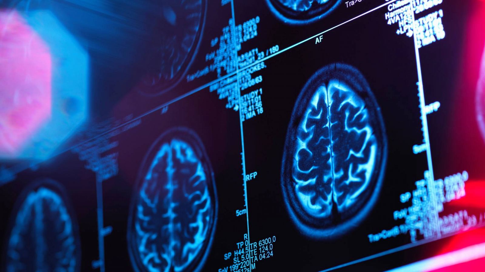 Radiografías cerebrales en una imagen de archivo
