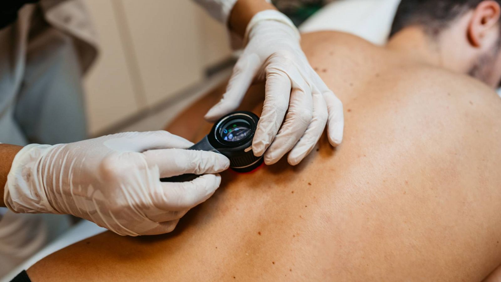 Una doctora examina las marcas en la piel de un paciente