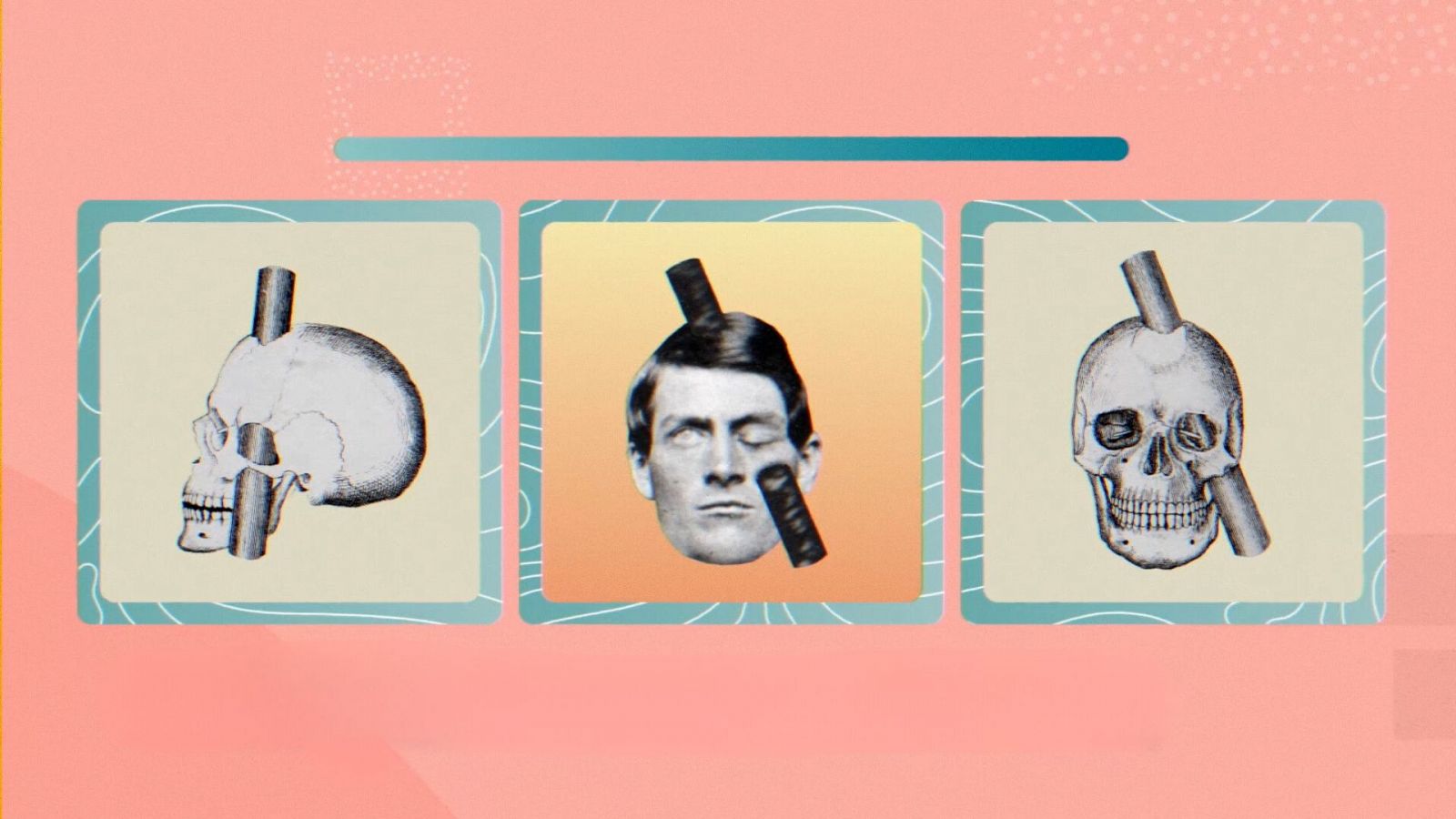 Frame Phineas Gage | El Cazador de Cerebros