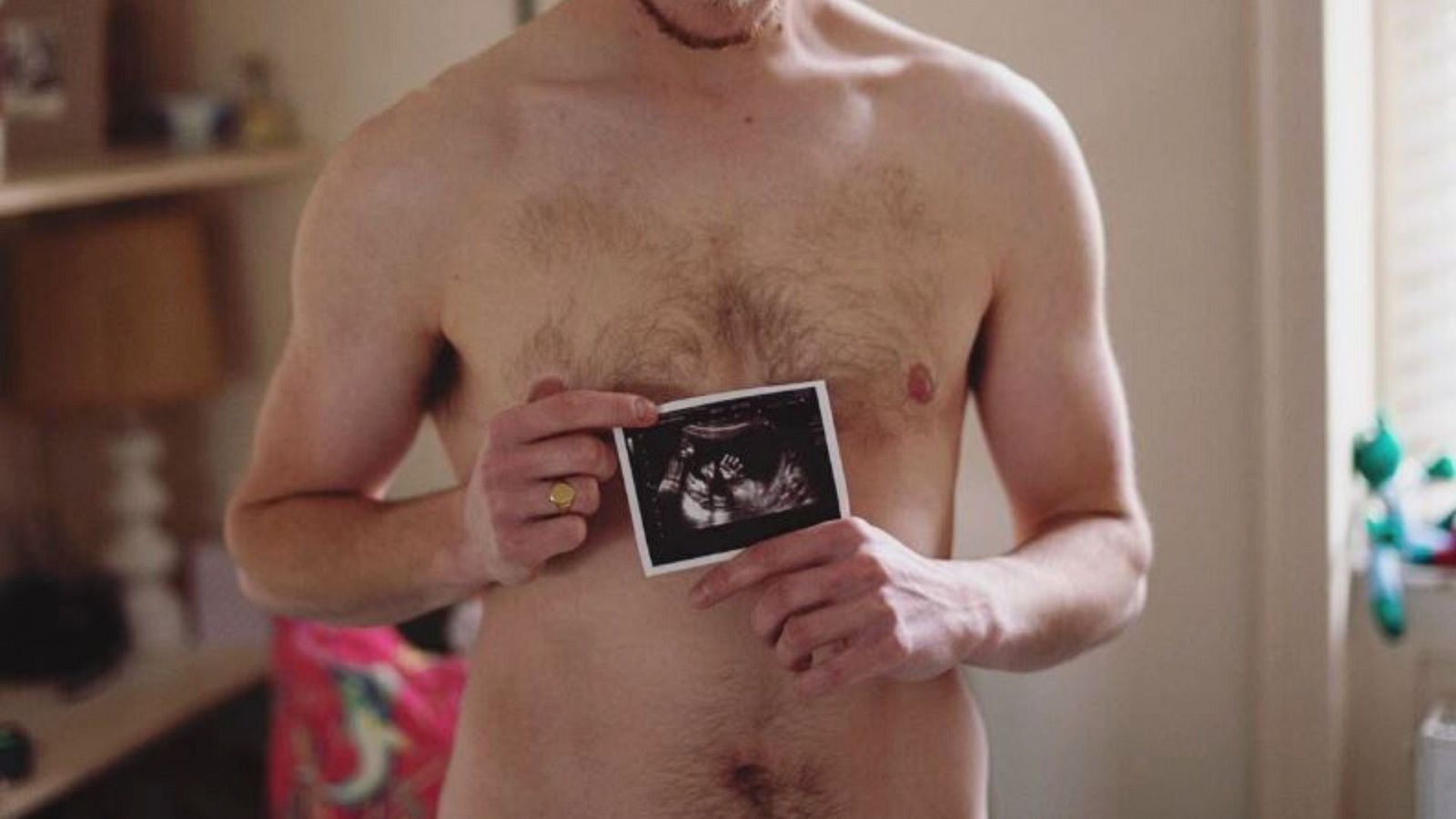 Un embarazo en un hombre trans: desterrando mitos