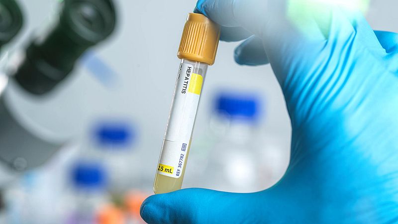 Una muestra de hepatitis, en una imagen de archivo