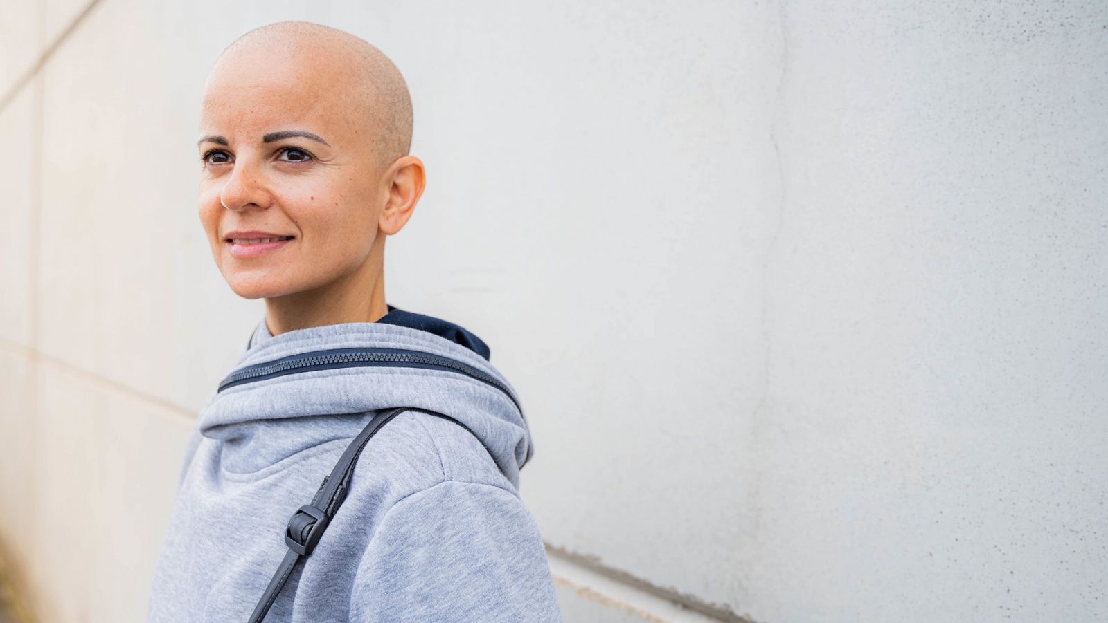 Muchas mujeres luchan contra el estigma de tener alopecia y reivindican un cambio en el canon de belleza