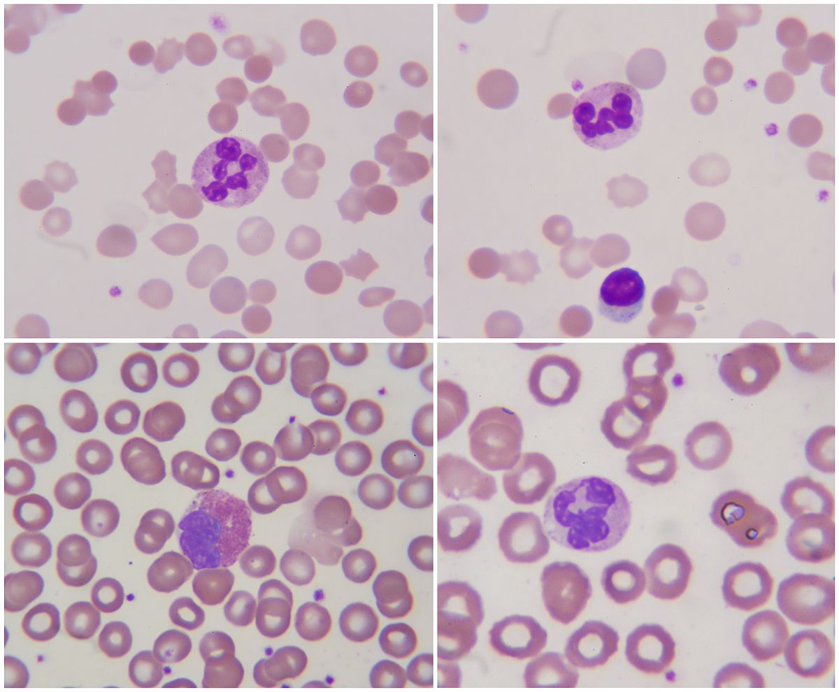 Sangre vista al microspcopio.