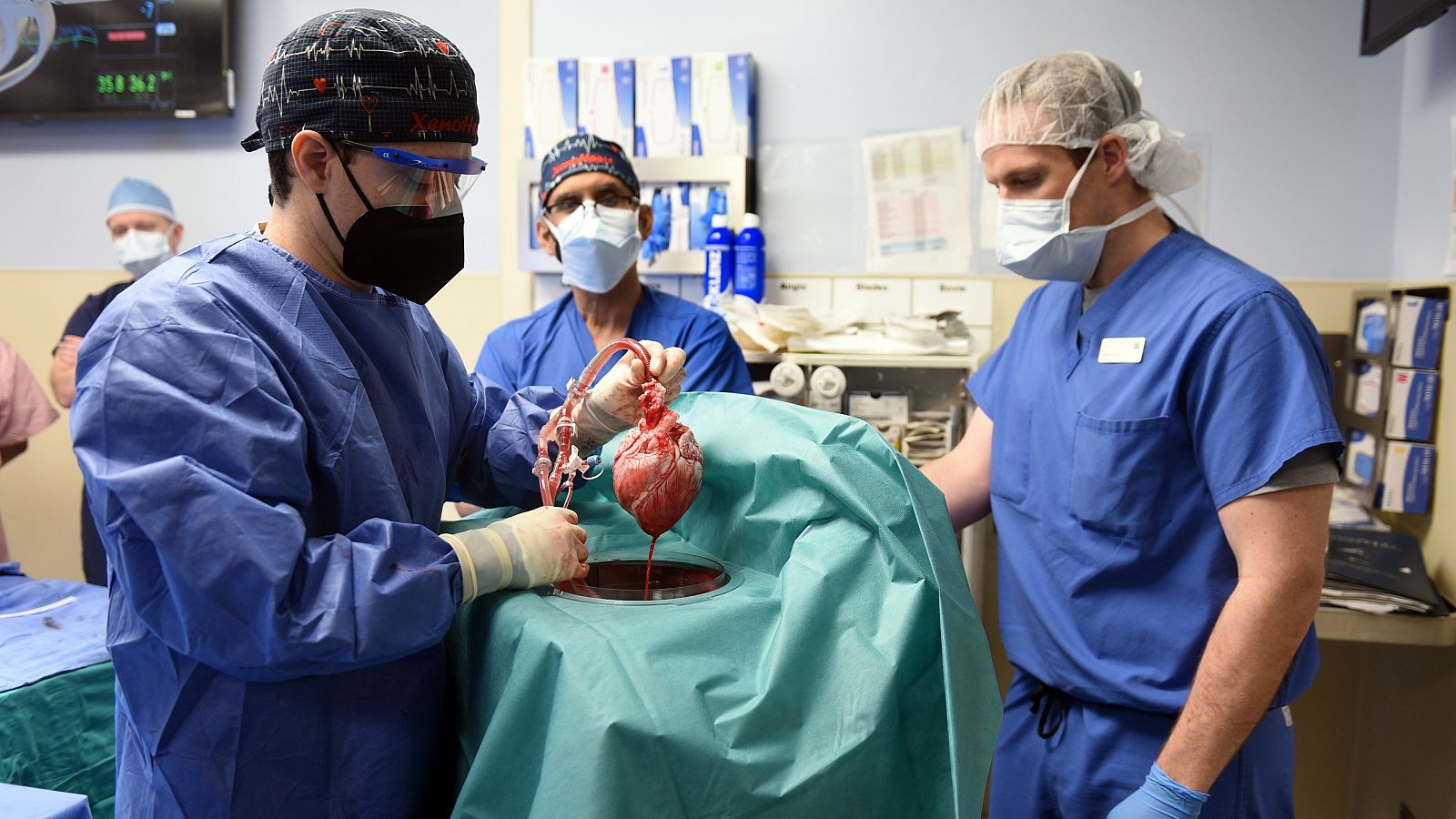 El equipo médico de la Universidad de Maryland muestra el corazón porcino durante la intervención.