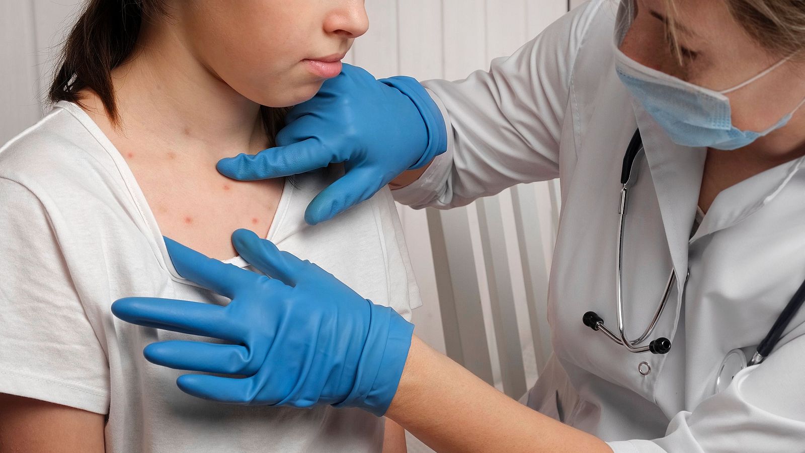 Resurgimiento del sarampión obedece a una menor vacunación.