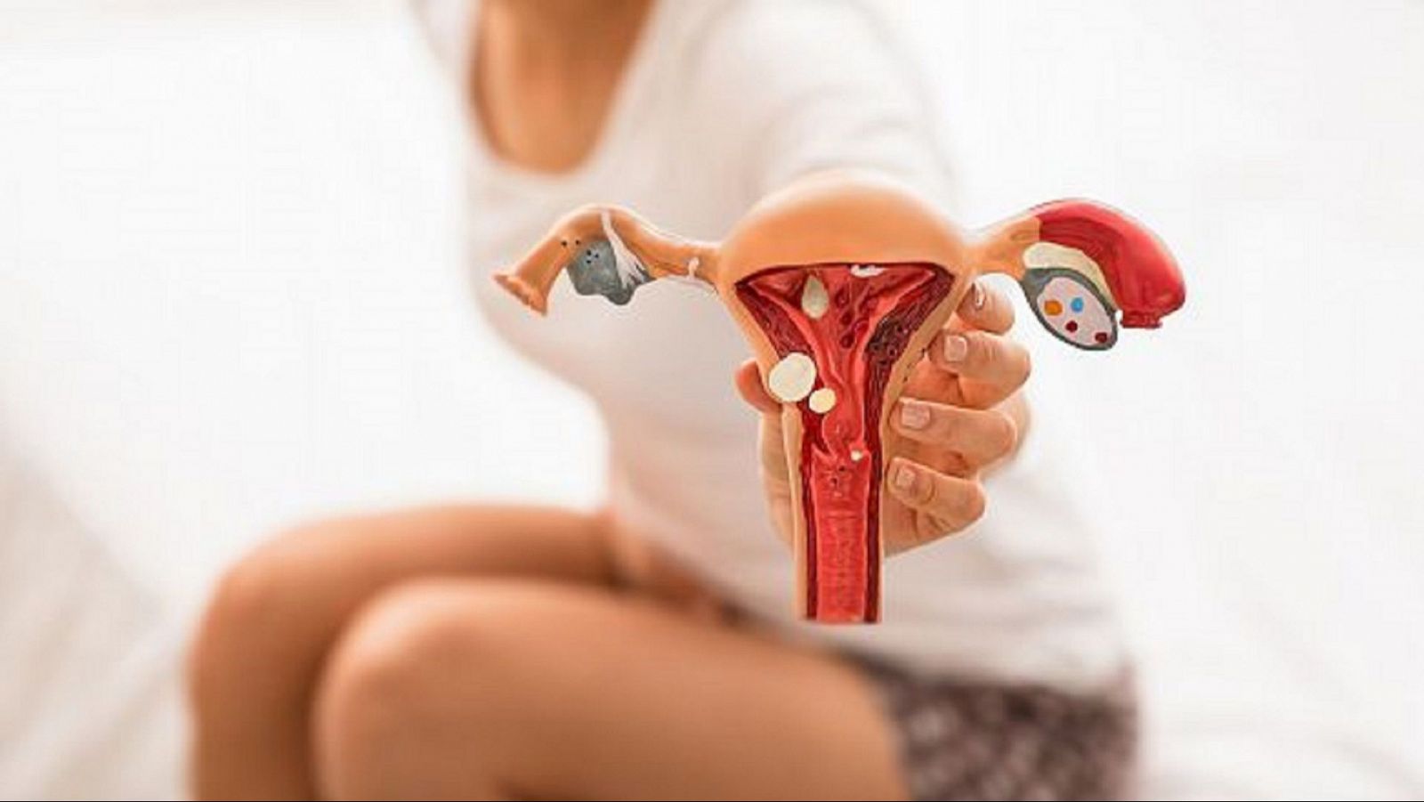 Com minimitzar les afectacions de l'endometriosi a les relacions sexuals.
