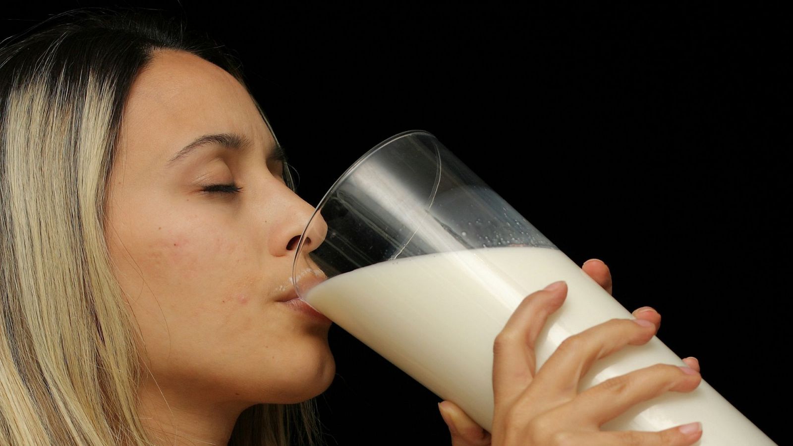 ¿Cómo influyen los lácteos en la aparición de acné?