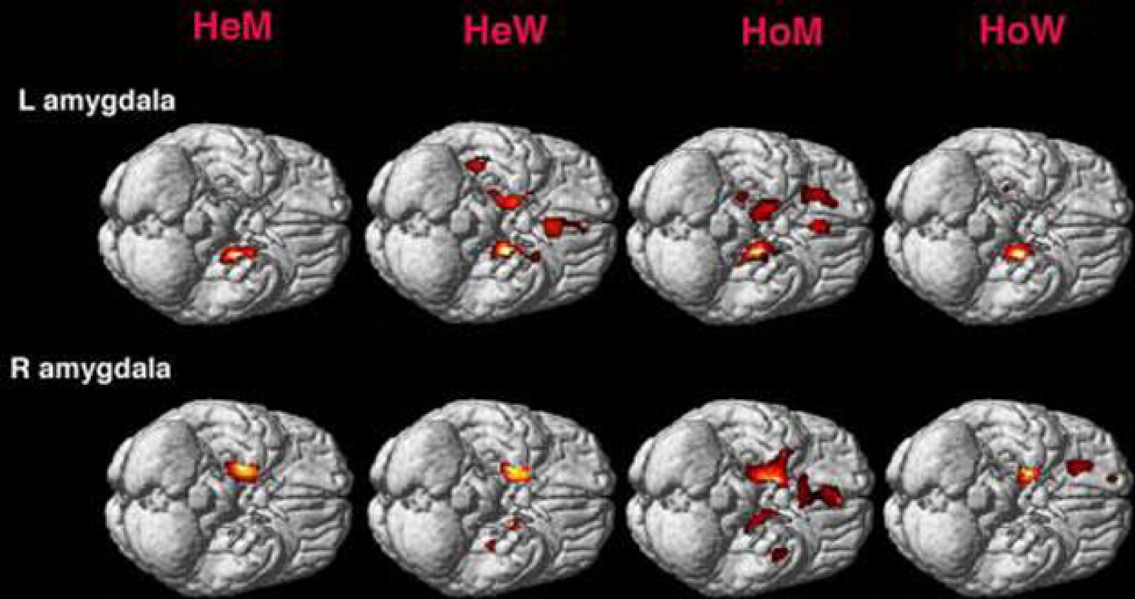 Imágenes de la amígdala cerebral en hombres y mujeres homosexuales y heterosexuales.