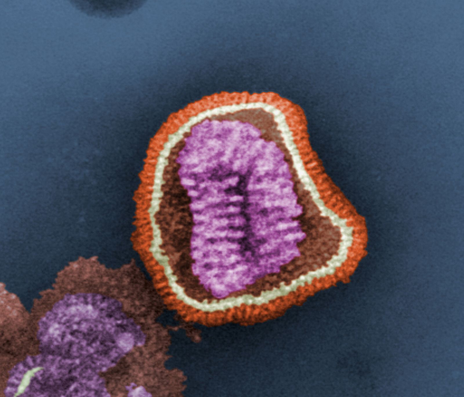 Particula del virus de la Influenza