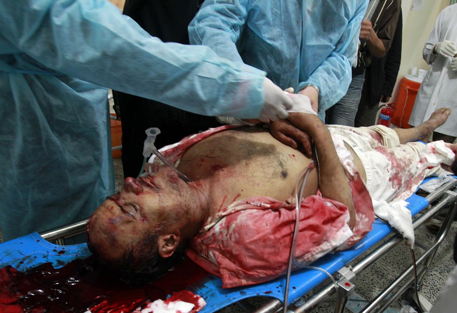 Los médicos atienden a un herido en los enfrentamientos de este martes en Saná, capital de Yemen