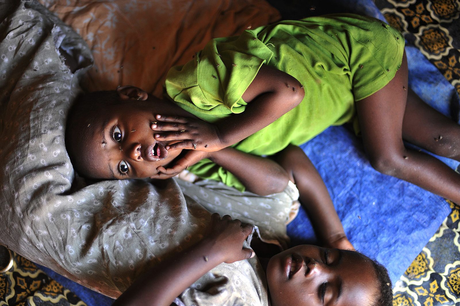 Dos niños son atendidos en un campo de refugiados del Cuerno de África.
