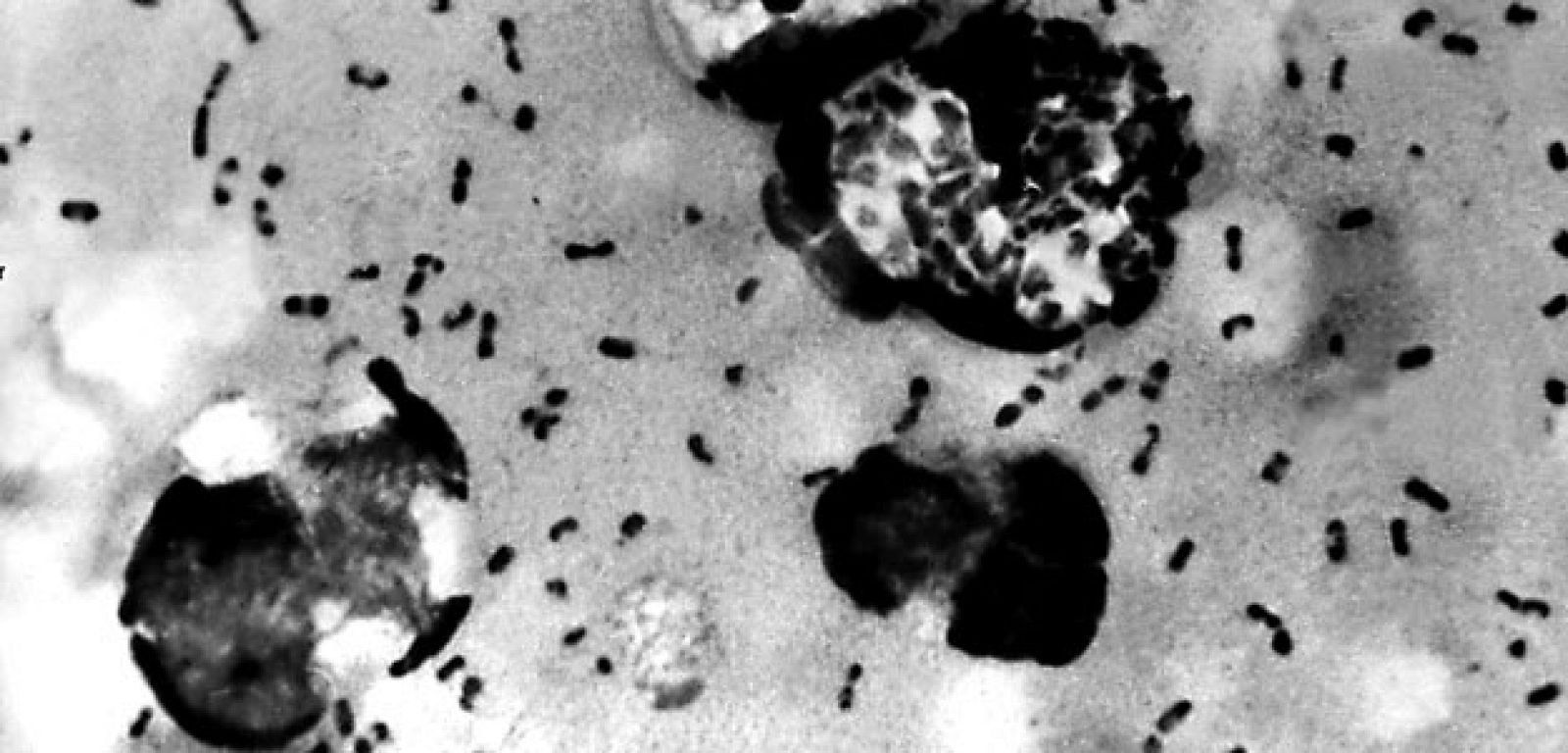 Imagen  de la bacteria de la peste negra o bubónica.