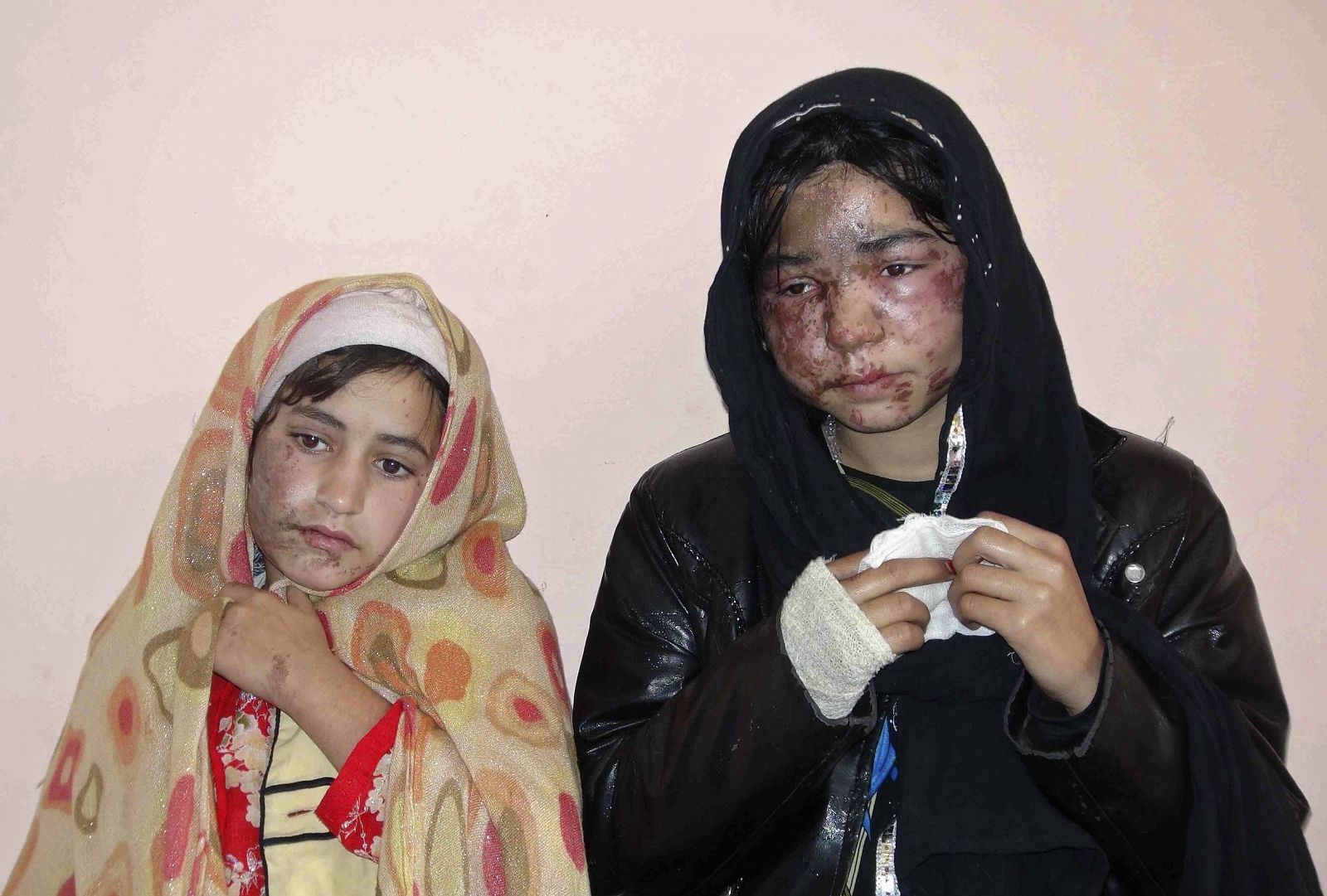 Dos de las hermanas que han sido atacadas con aceite en Afganistán