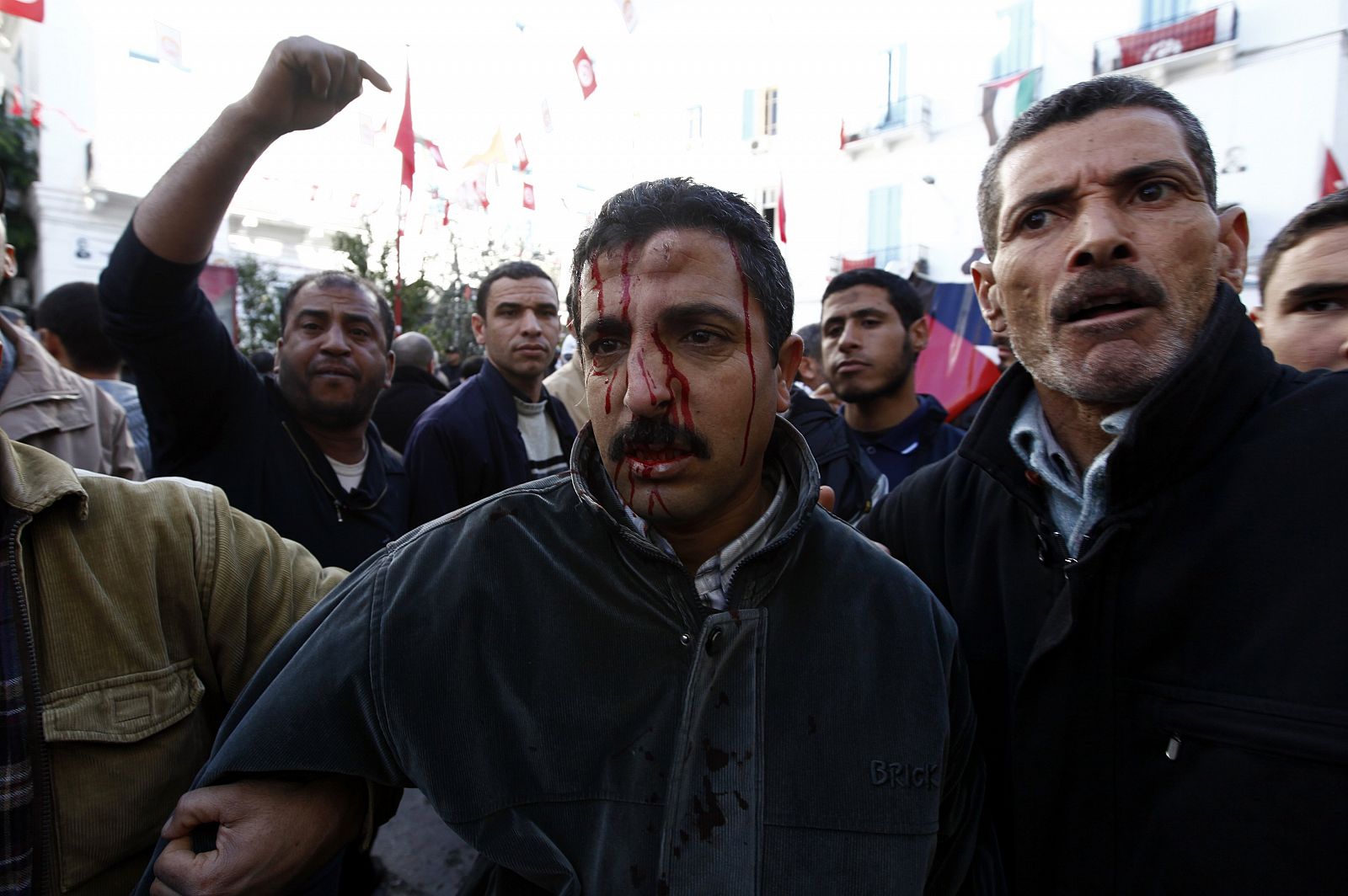 Un hombre herido tras el ataque de islamistas a la sede del sindicato UGTT en Túnez.