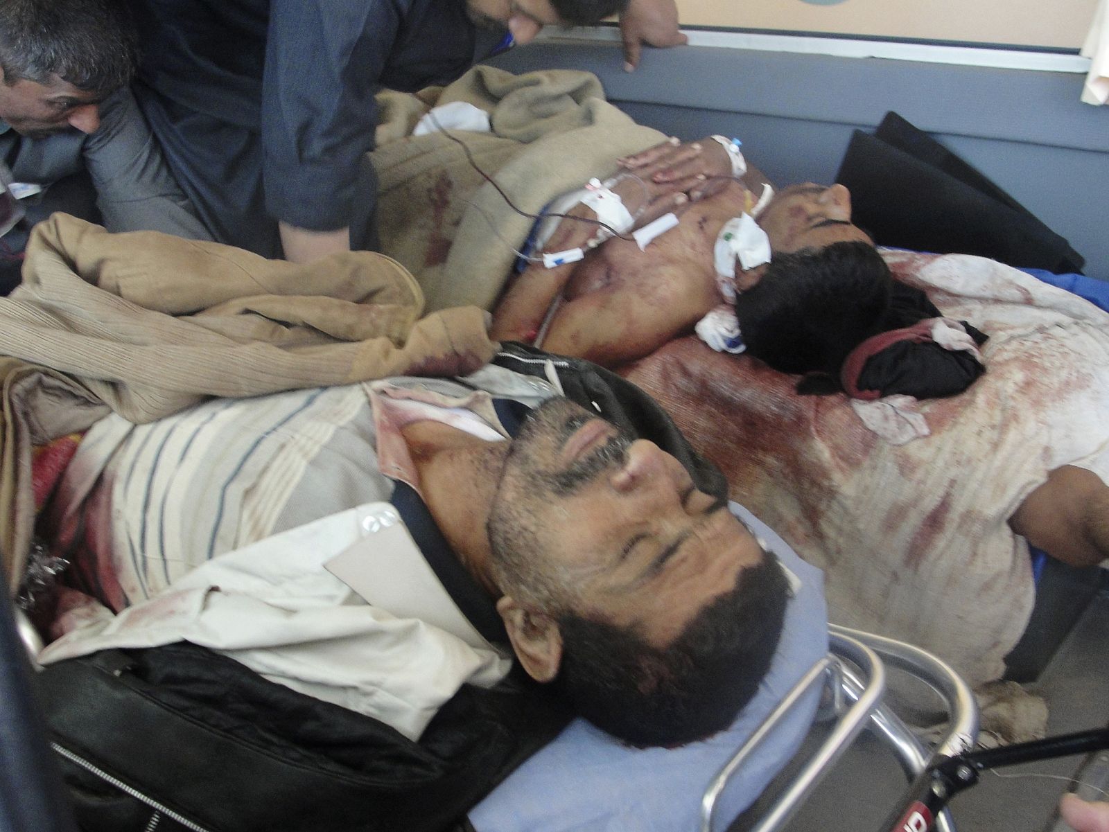 Dos hombres en una cama de hospital heridos en un enfrentamiento con fuerzas de seguridad iraquíes en Kirkuk.