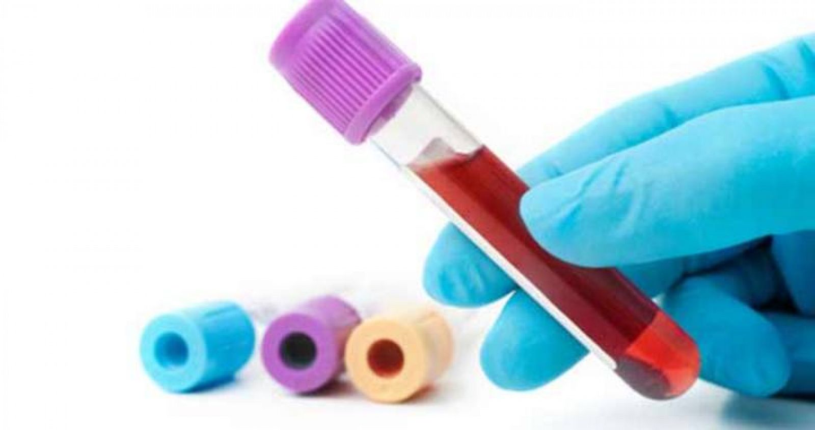 Un análisis de sangre será suficente para detectar problemas cognitivos en pacientes de cirrosis hepática