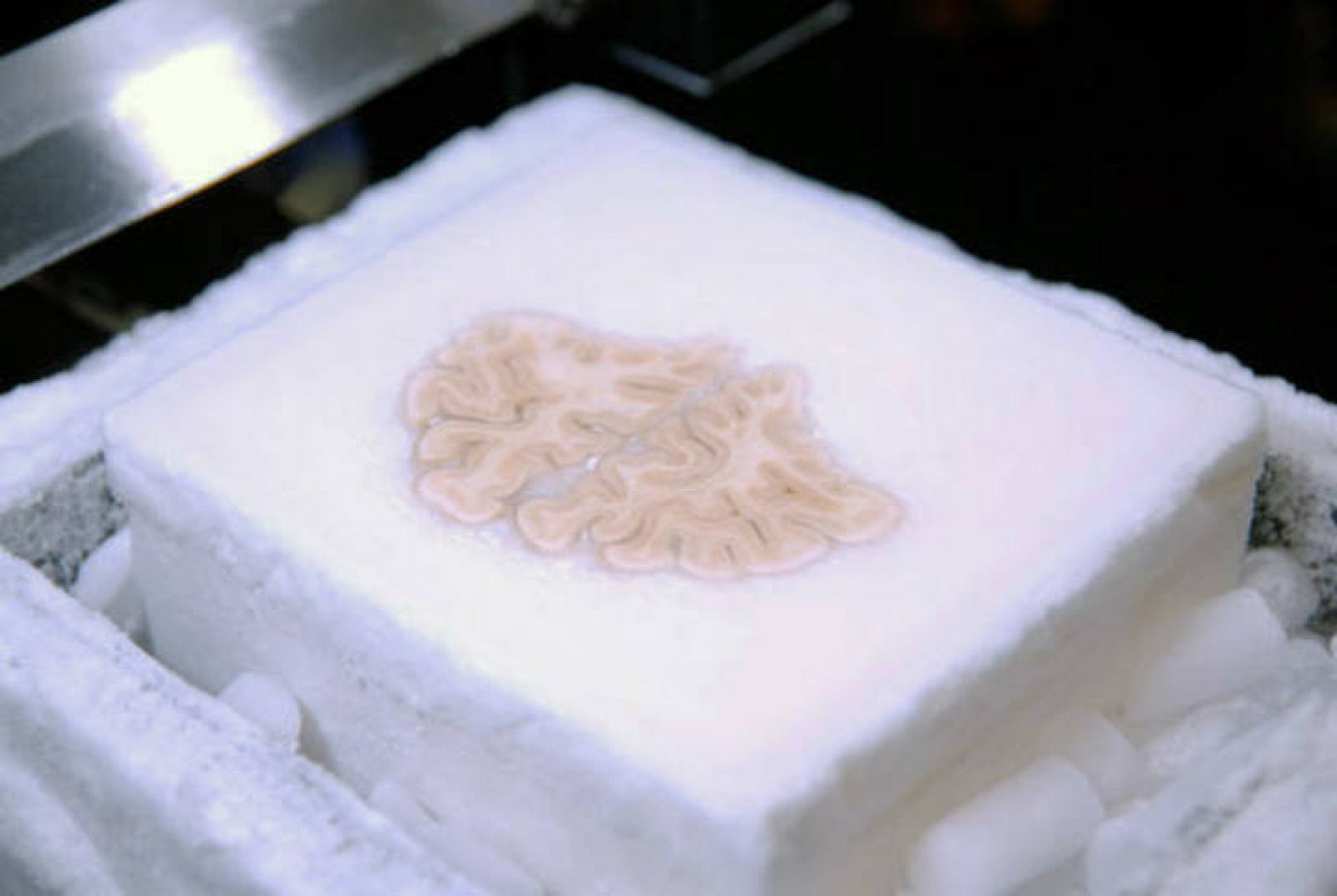 El cerebro de Henry Molaison, criogenizado.