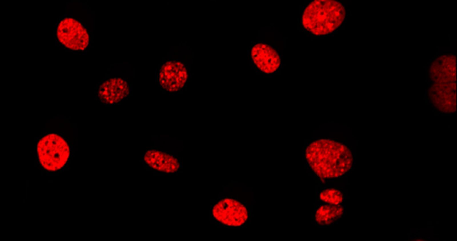 Células tumorales con daño en el ADN celular (rojo) después del tratamiento con etopósido.