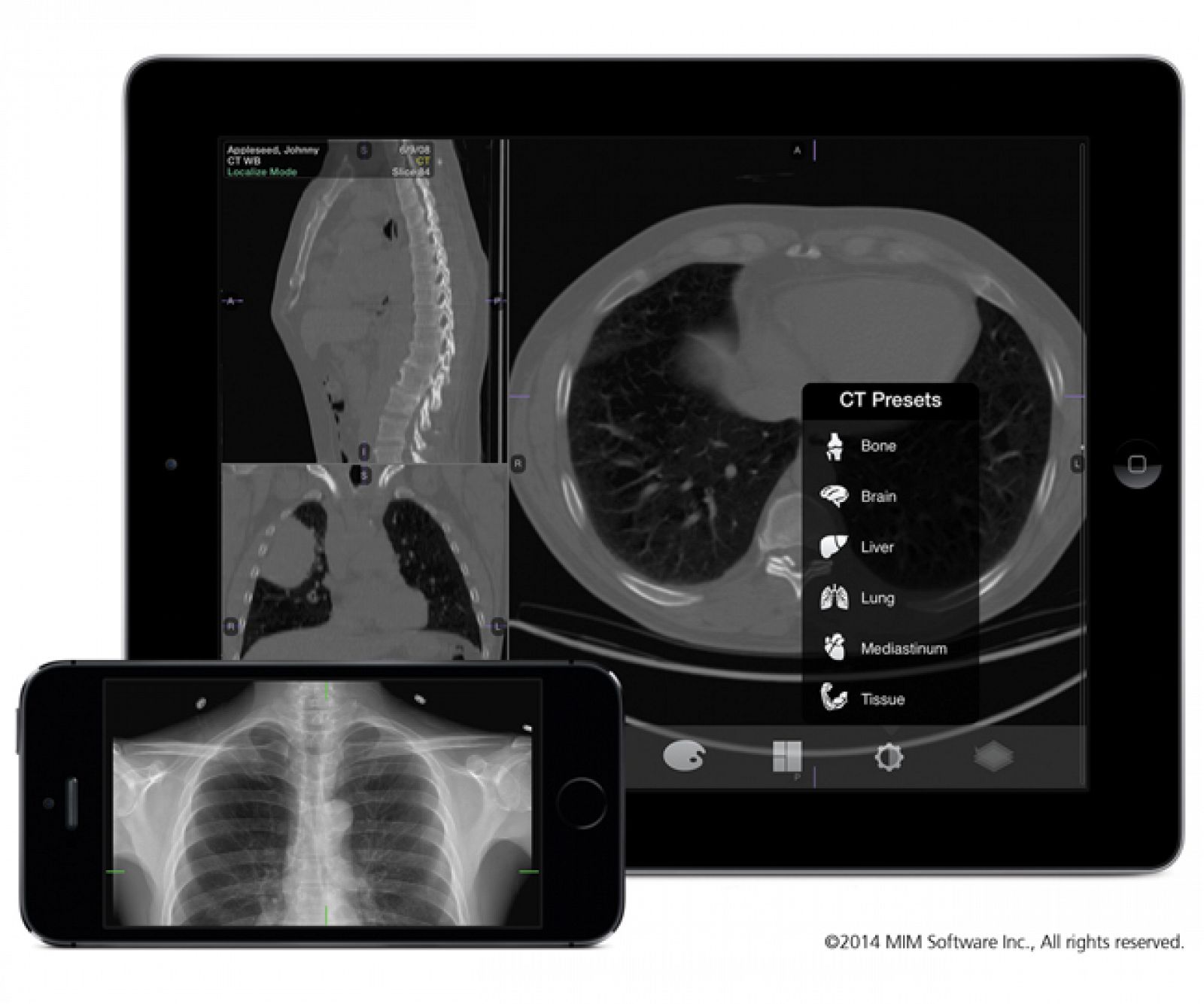 Una radiografía de los pulmones en un móvil y en una tableta.