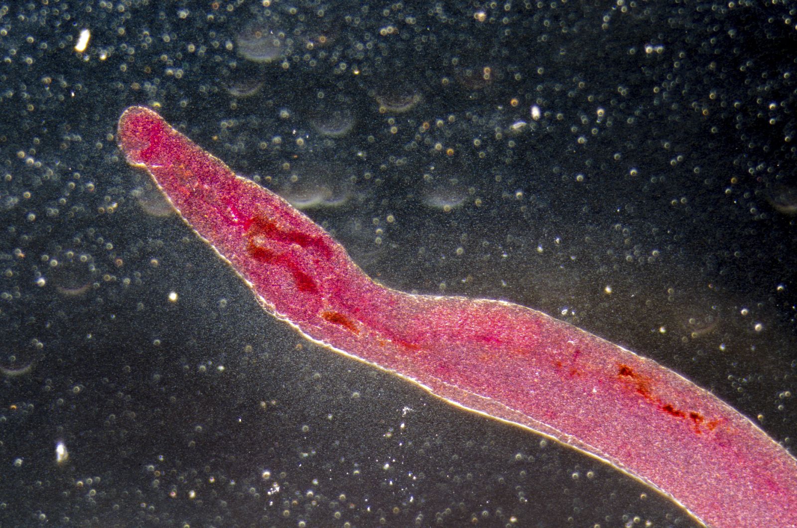 El parásito Schistosoma.