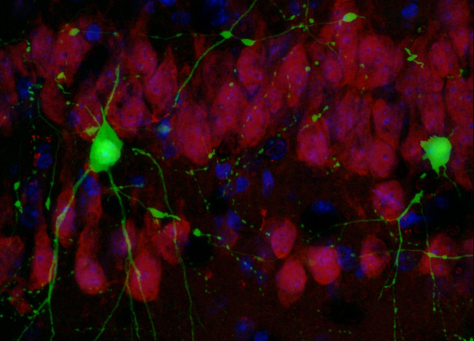 Detección de la poteïna Crtc1 en neuronas del hipocampo de ratón. La proteína destaca en color verde.