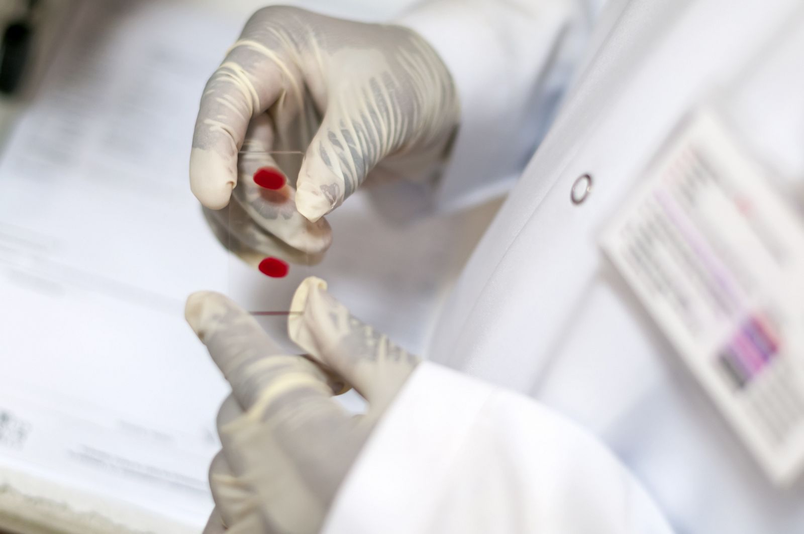 Análisis de sangre en un laboratorio.