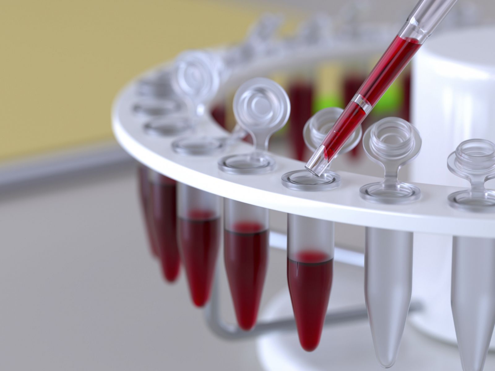 Test de sangre en un laboratorio.