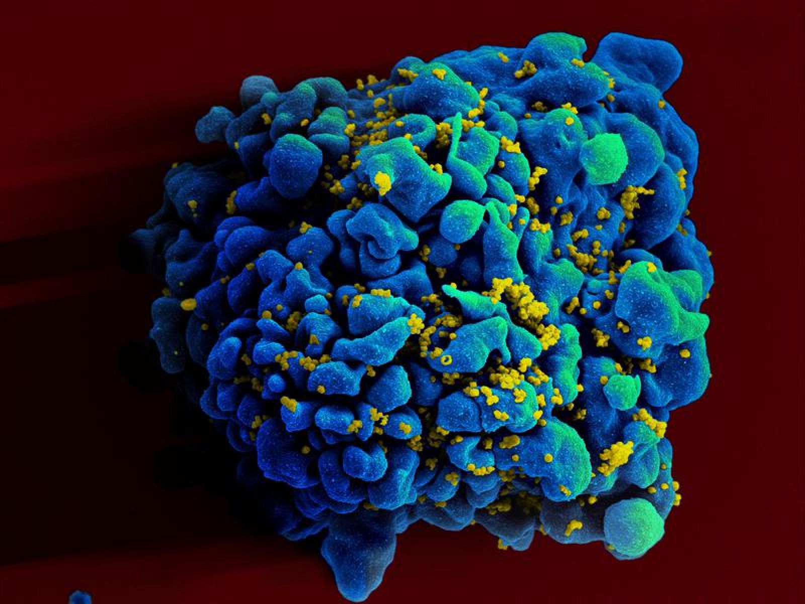 Electromicrografía de una célula Th9 infectada con VIH