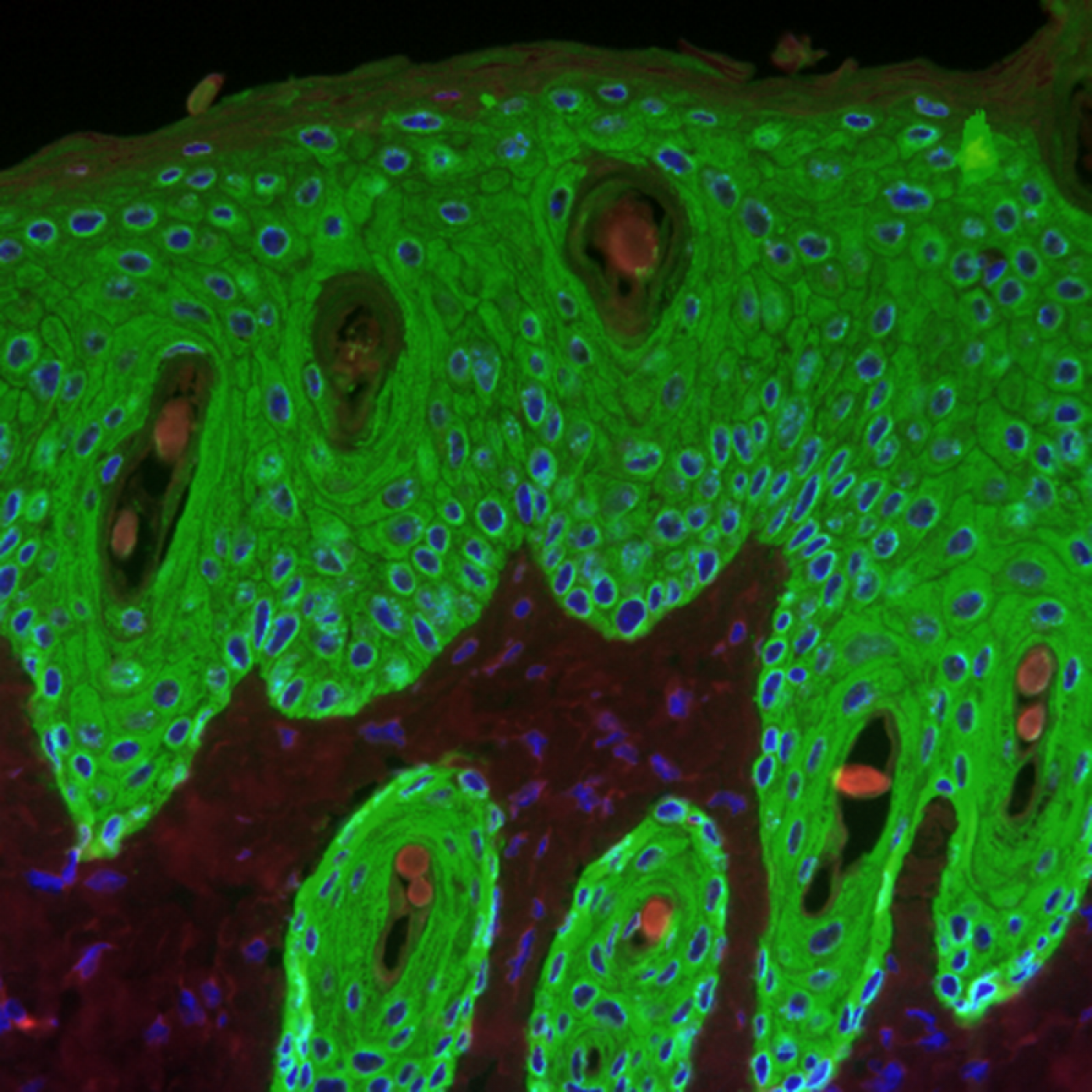 Queratinocitos (en verde) de la piel de un ratón.