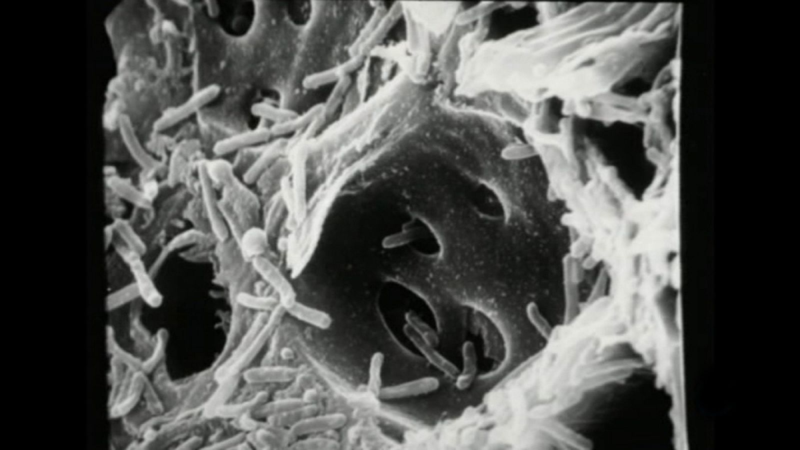 Imagen microscópica de la bacteria Xylella fastidiosa