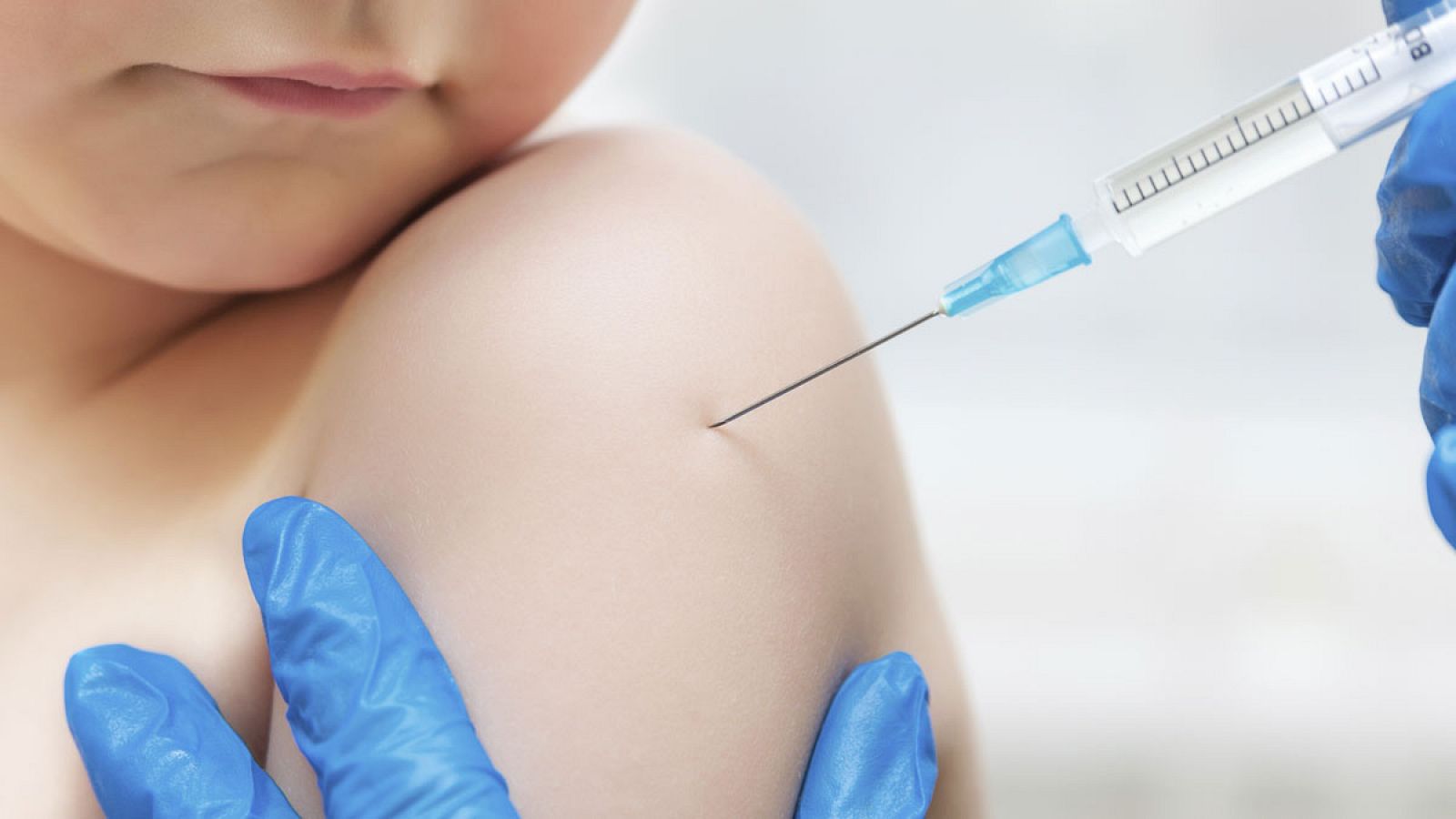 Los pediatras señalan que la inmunización de la población es la medida más eficaz.
