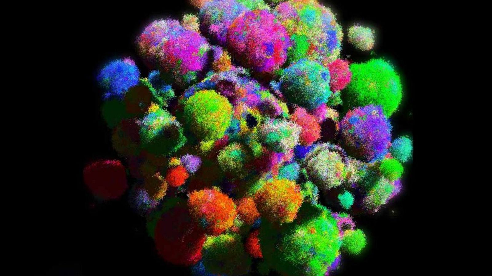 Este es un modelo tridimensional de un tumor que muestra tipos de células de diferentes colores