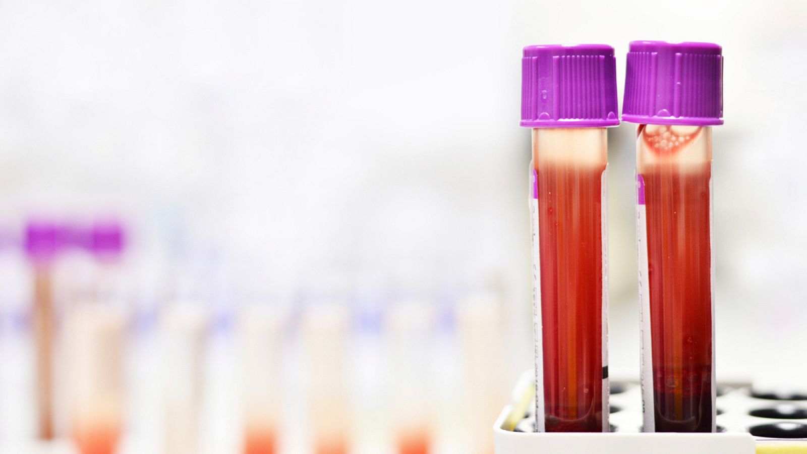 El estudio se ha centrado en el envejecimiento de las células madre responsables de regenerar las células de la sangre.