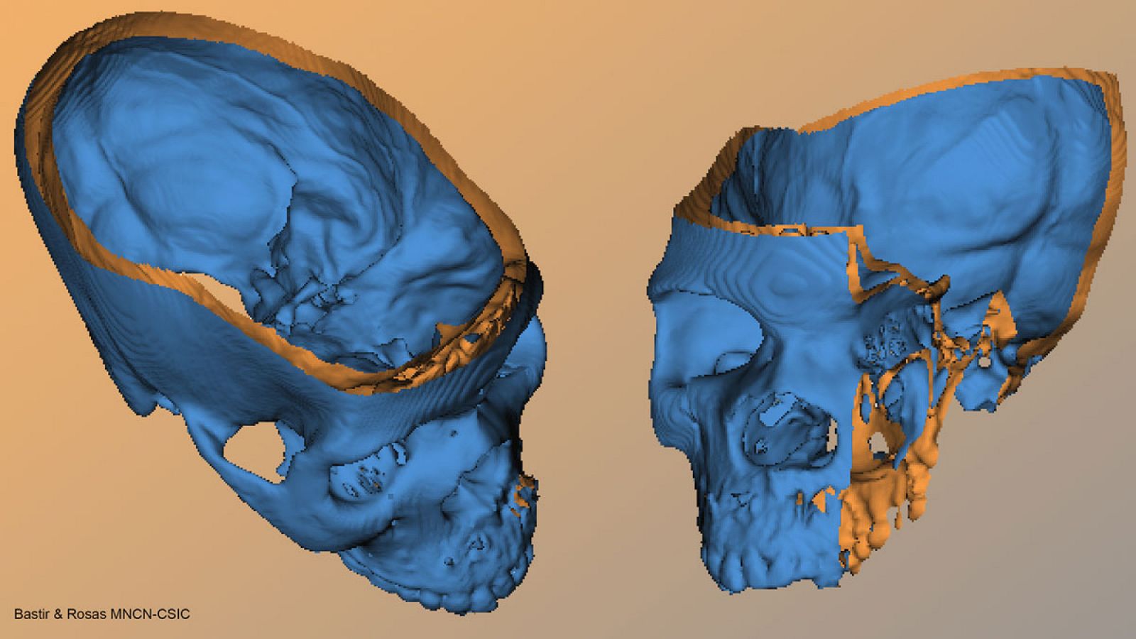 Ilustración de las relaciones espaciales entre la base del cráneo, donde se apoyan los lóbulos del cerebro, y la posición del esqueleto facial.