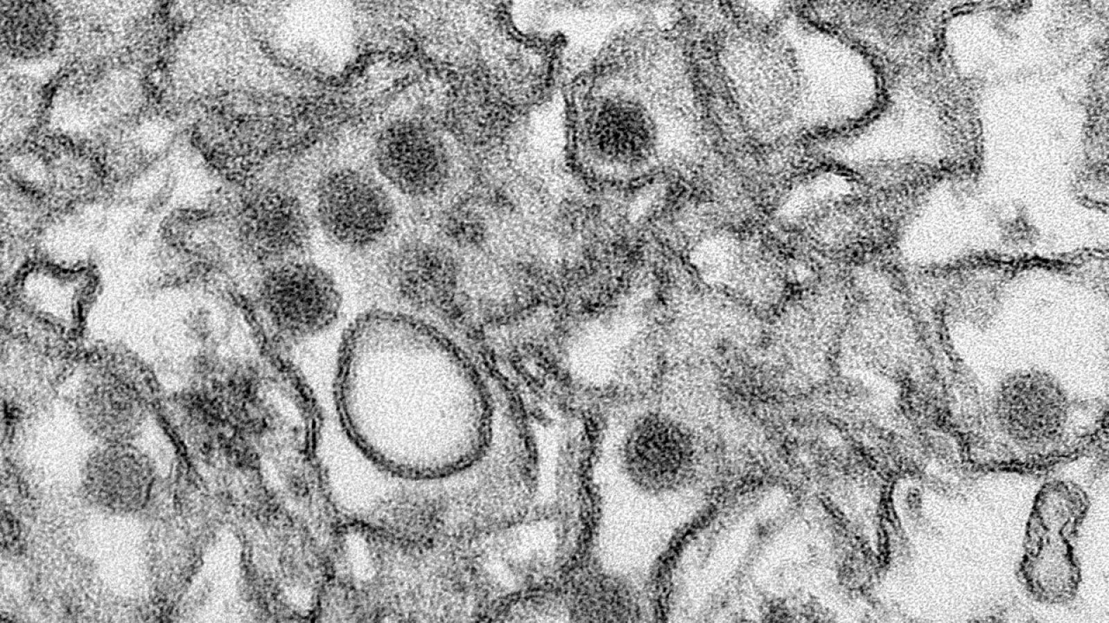 Imagen del virus del Zika tomada por el Centro de Control de Enfermedades de Atlanta, en Estados Unidos