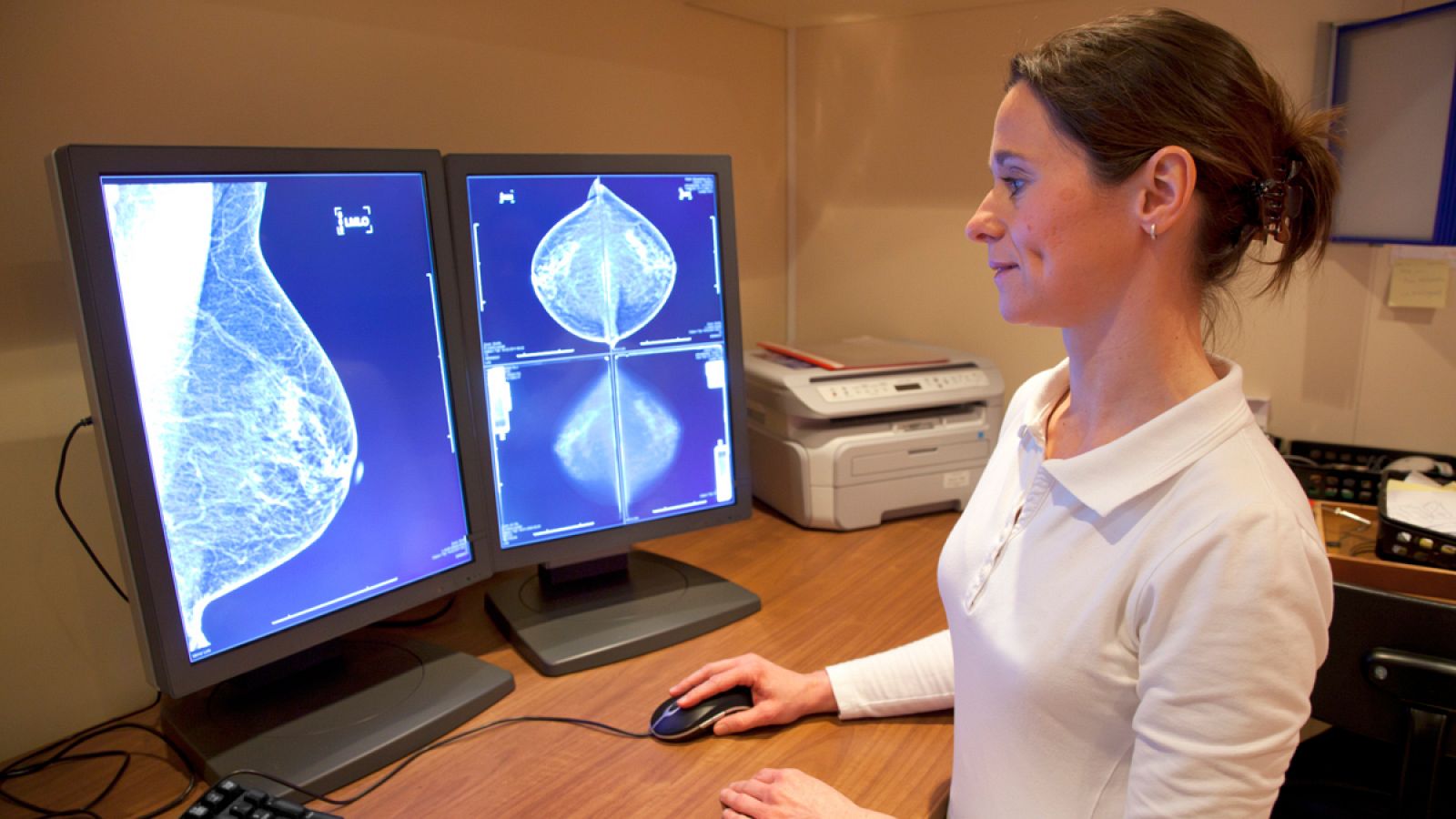 La prueba estará destinada a mujeres con alto riesgo de padecer cáncer de mama.