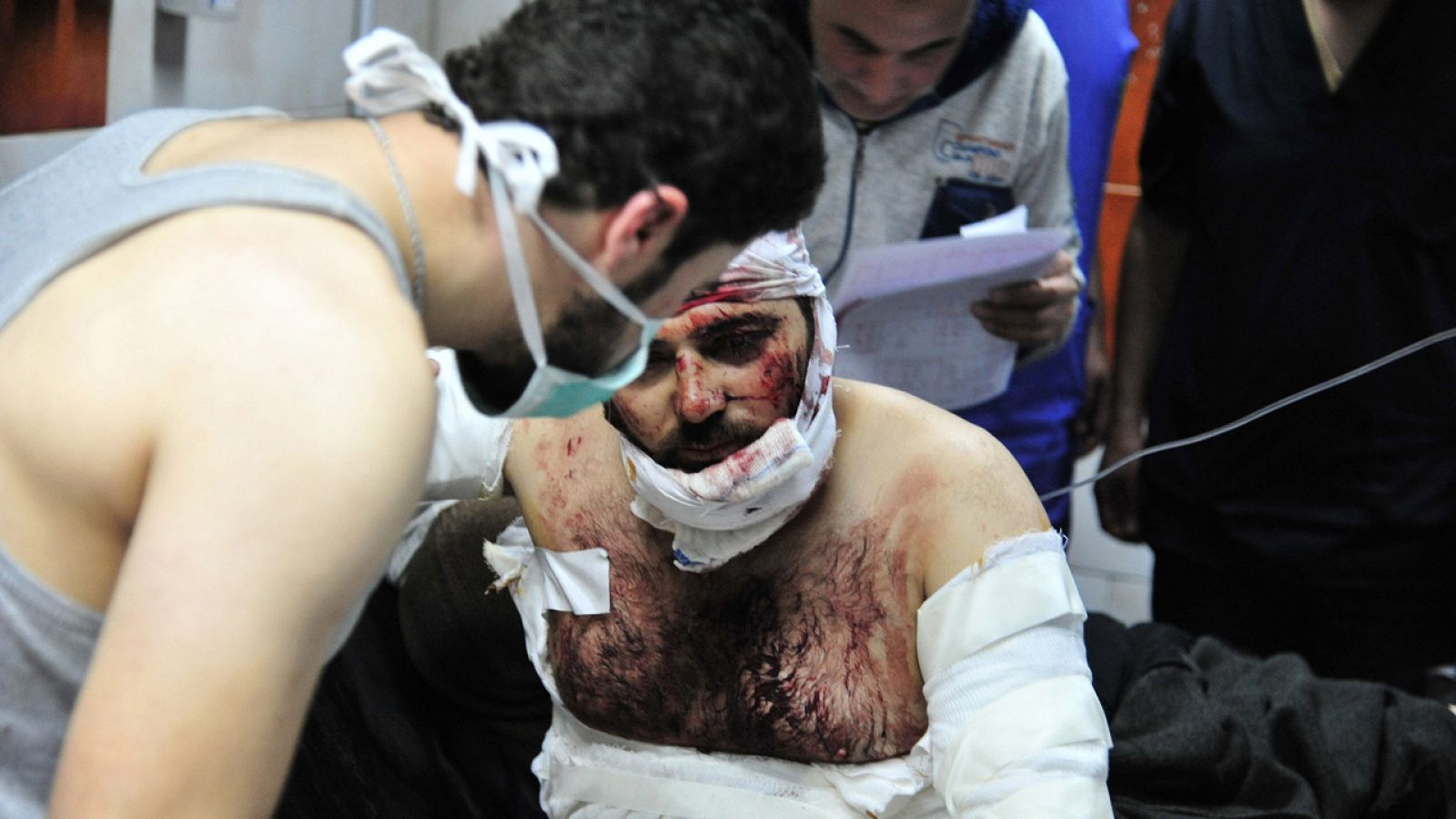 Un herido sirio por una explosión es atendido en un hospital de Damasco