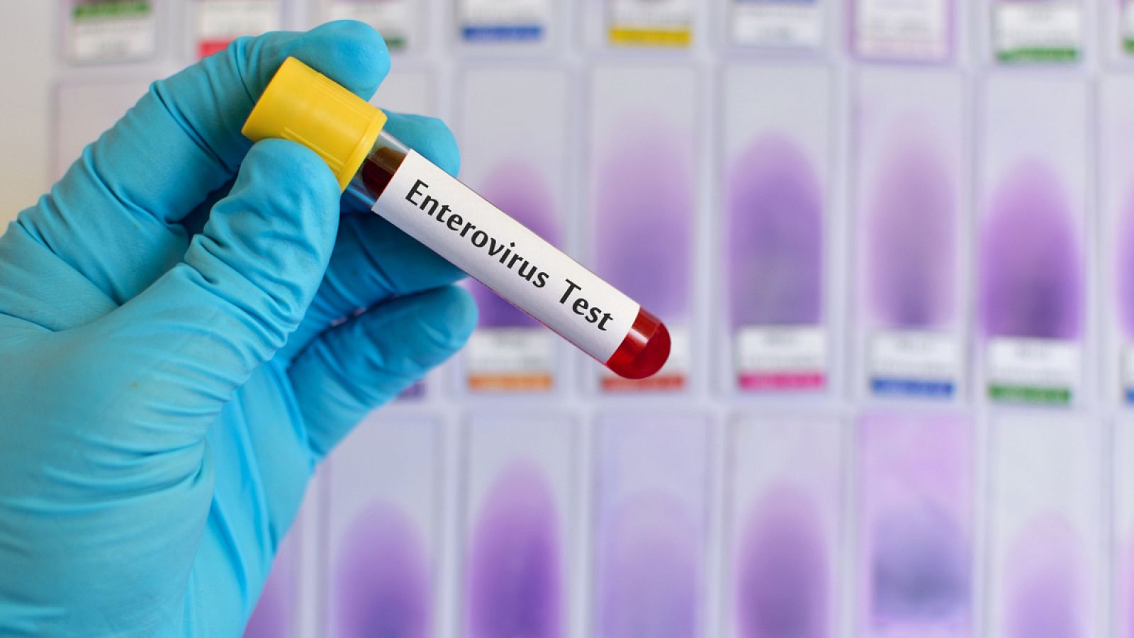 Hasta ahora, se han producido epidemias de enterovirus en Estados Unidos, Canadá y China.