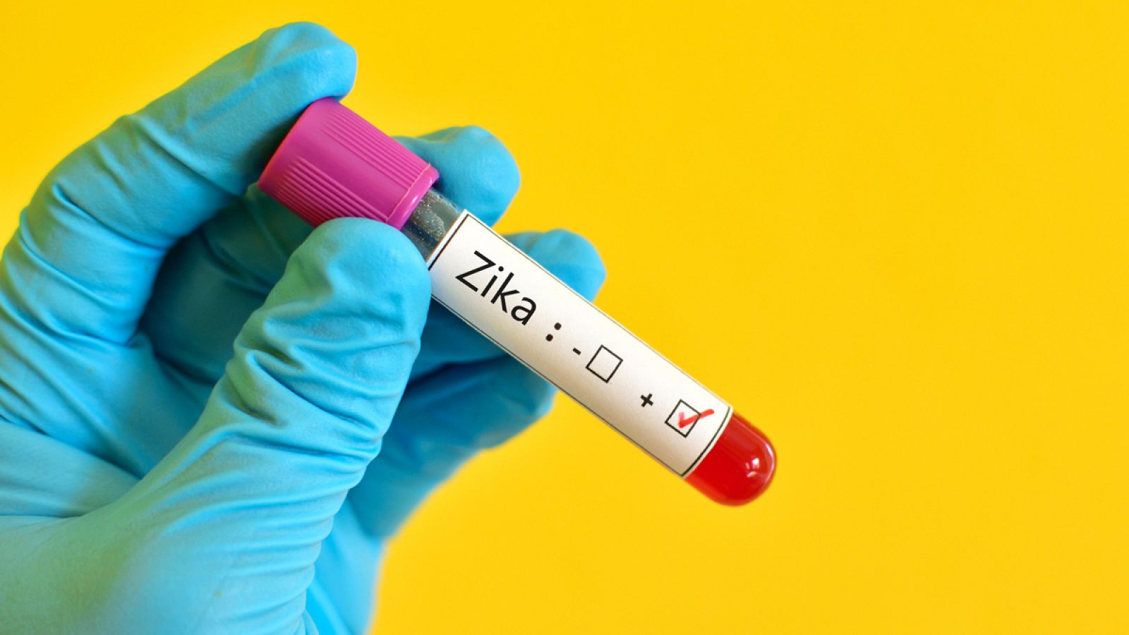 Más de medio centenar de países y territorios en todo el mundo sufren la epidemia del zika.