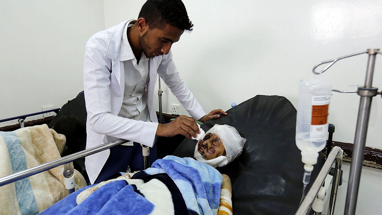 Un niño herido recibe tratamiento médico en un hospital tras un asalto aéreo por una intervención militar saudí en un mercado de Saná, Yemen,.