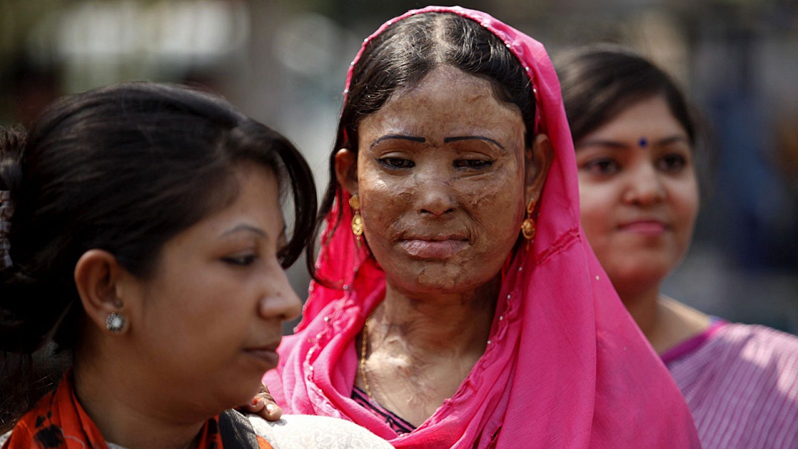 La justicia india ha condenado por primera vez a un hombre por un ataque con ácido.