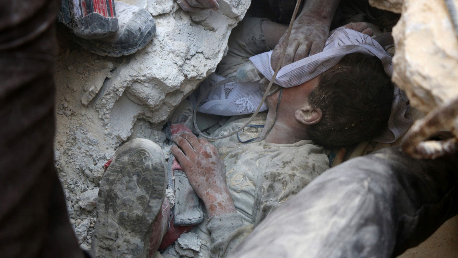 Un joven sirio recibe oxígeno mientras es rescatado tras un ataque aéreo ruso en Alepo