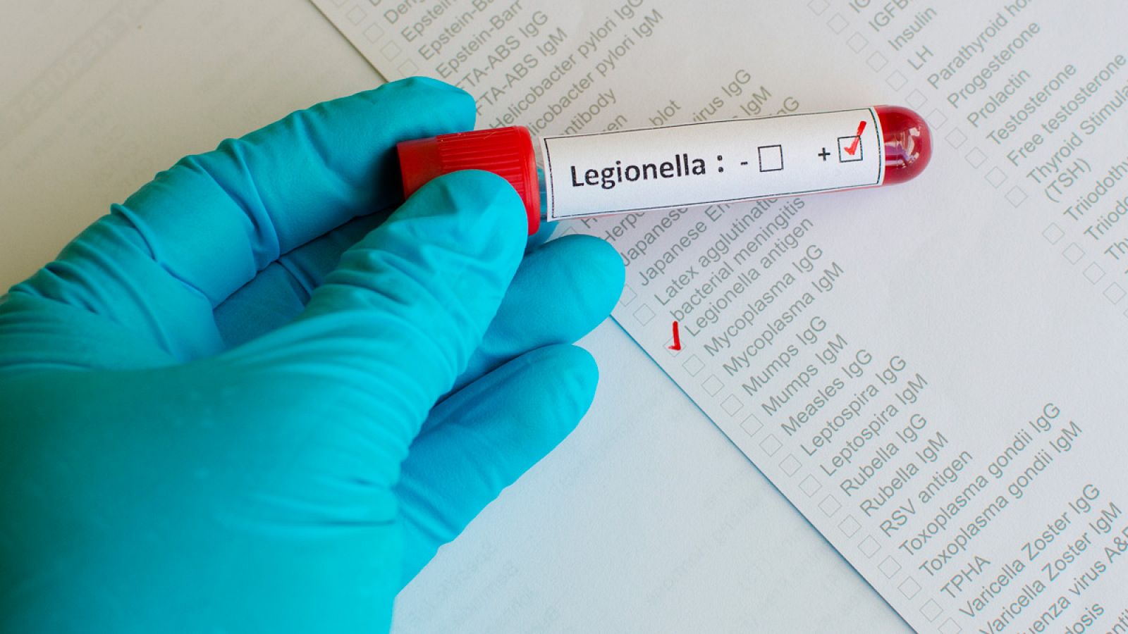 Legionela y legionelosis