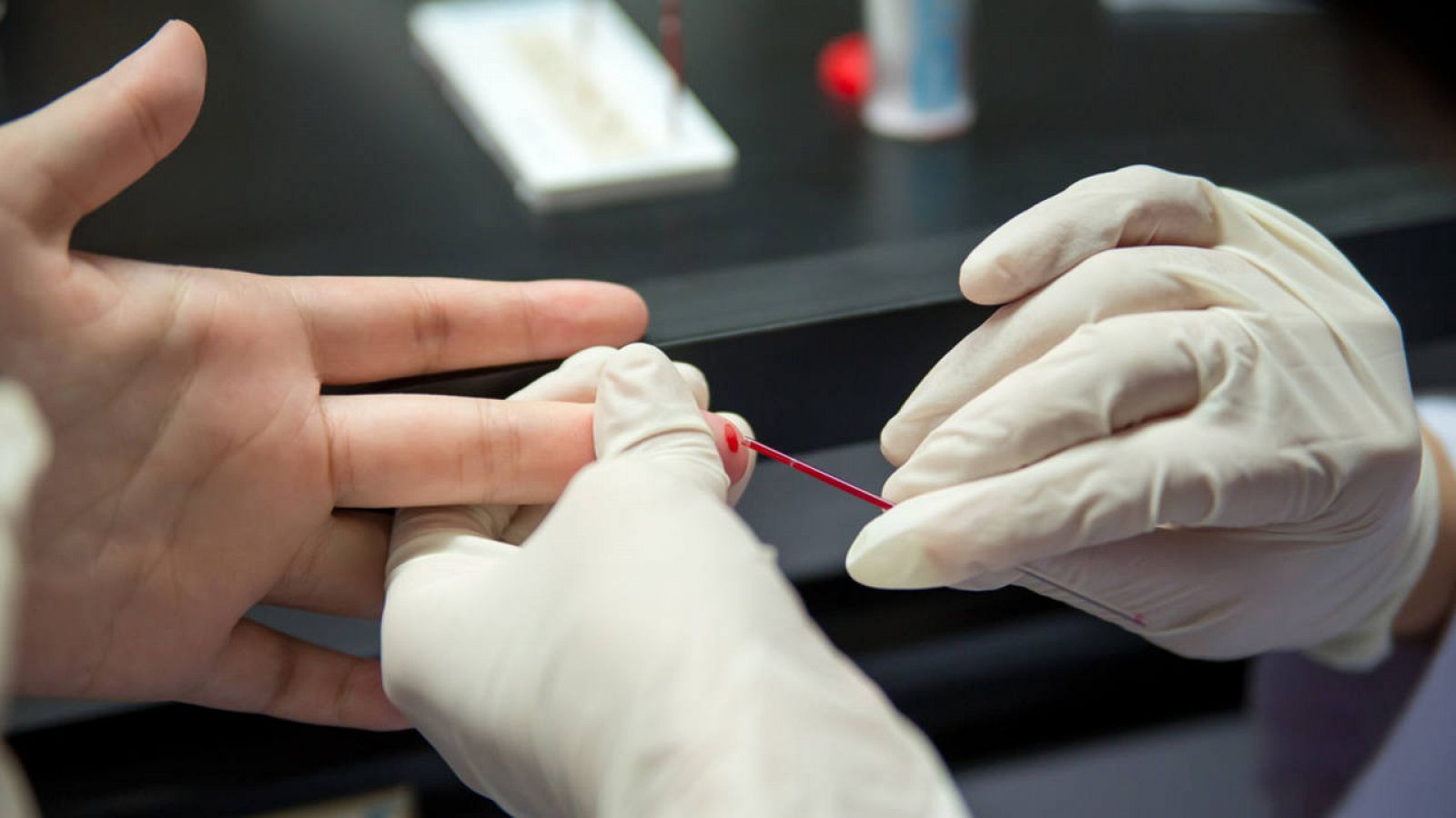 La prueba del VIH tiene una fiabilidad del 100% y cuesta tres euros.