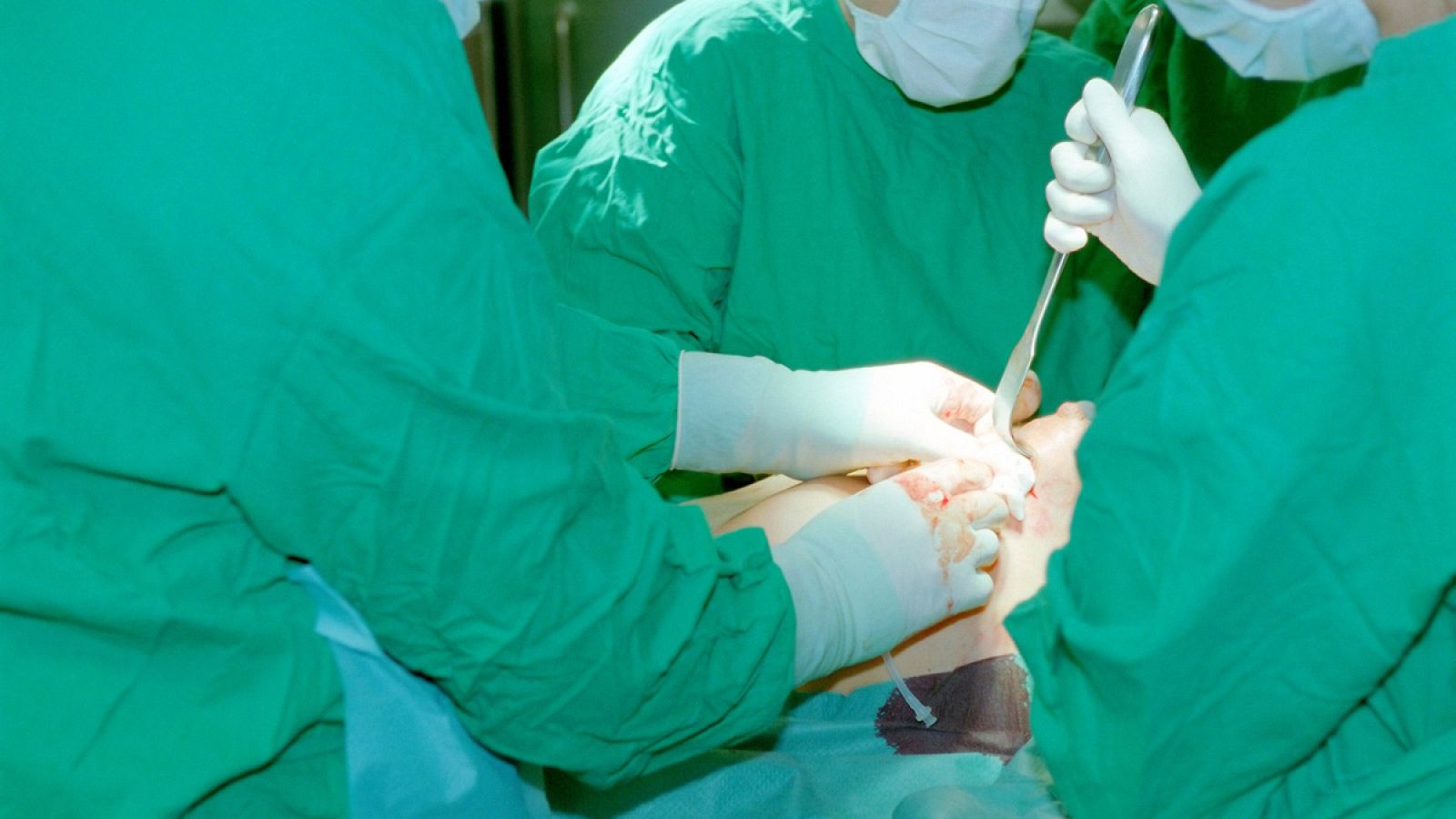 Los profesionales creen que las demoras se deben a la escasez de cirujanos plásticos en los hospitales públicos.